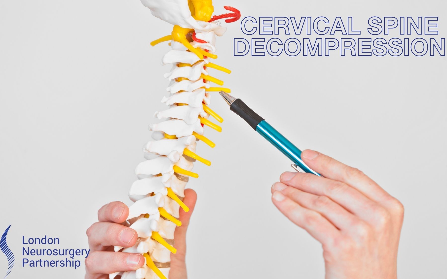 Cervical spine decompression - London Neurosurgery Partnership