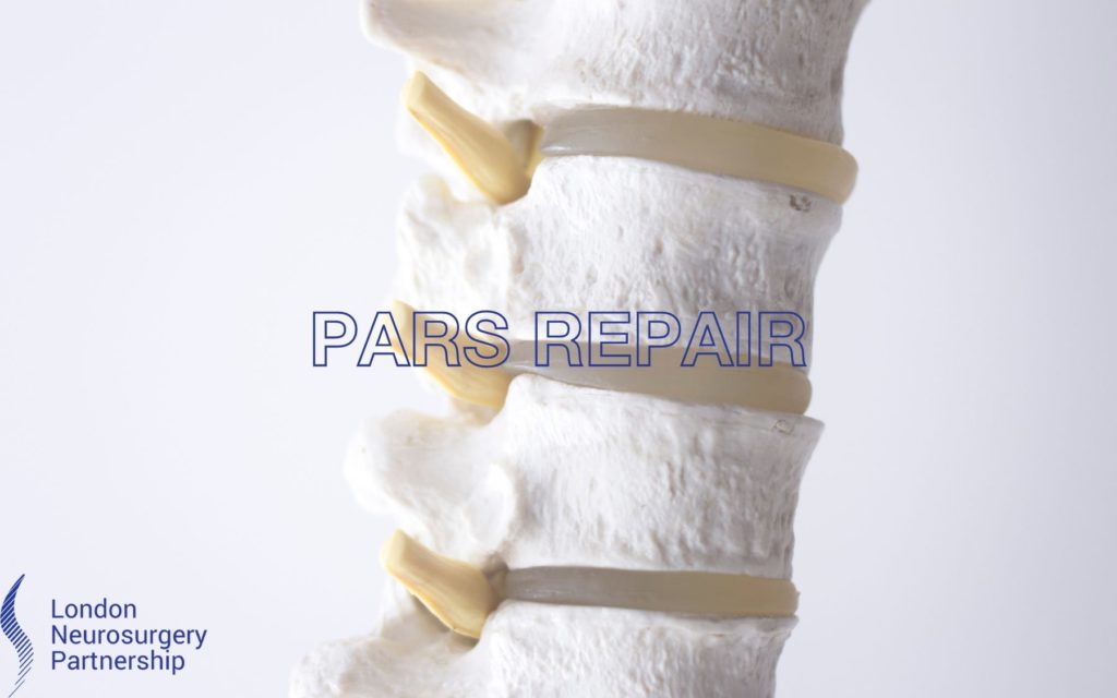 Pars repair