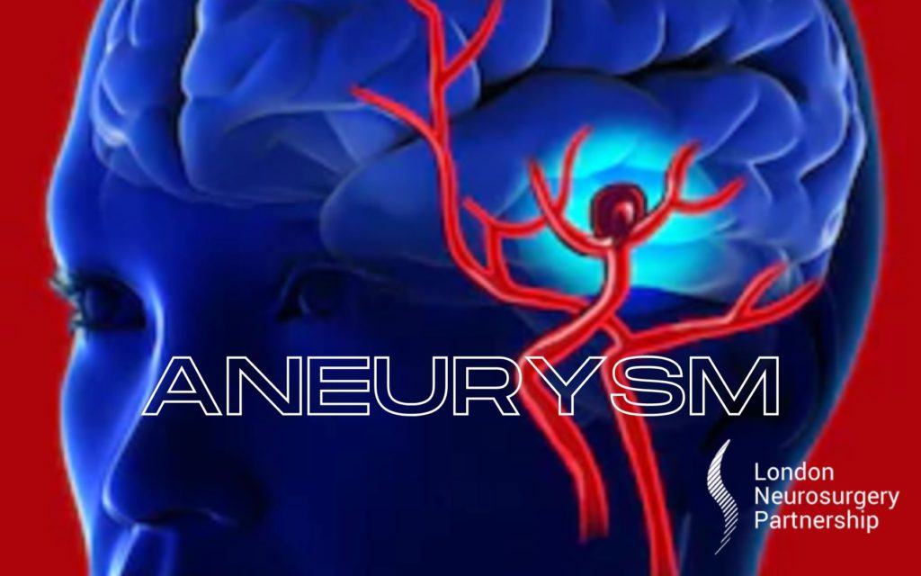 aneurysm london neurosurgery partnership