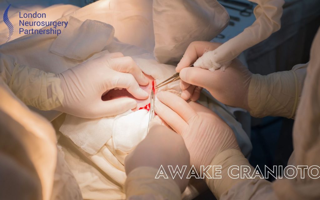 awake-craniotomy-london-neurosurgery-partnership