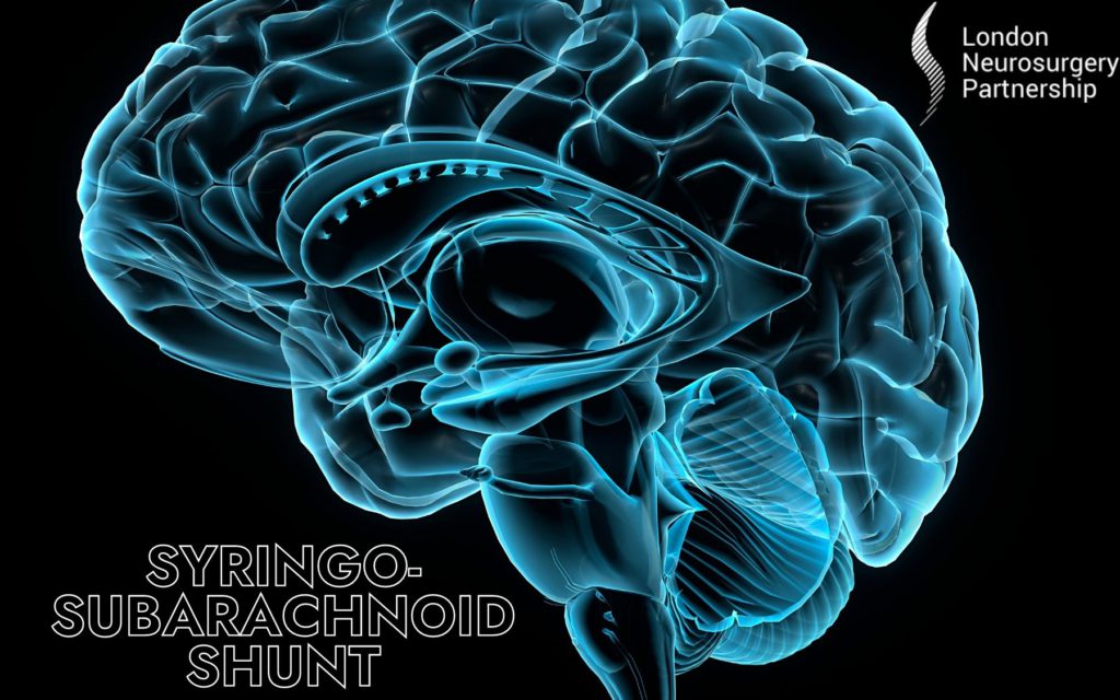 syringosubarachnoid shunt