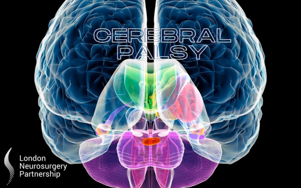 cerebral palsy london neurosurgery partnership