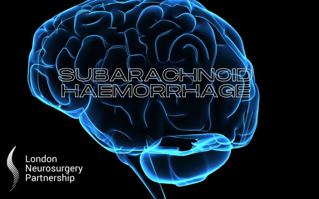 subarachnoid haemorrhage london neurosurgery partnership