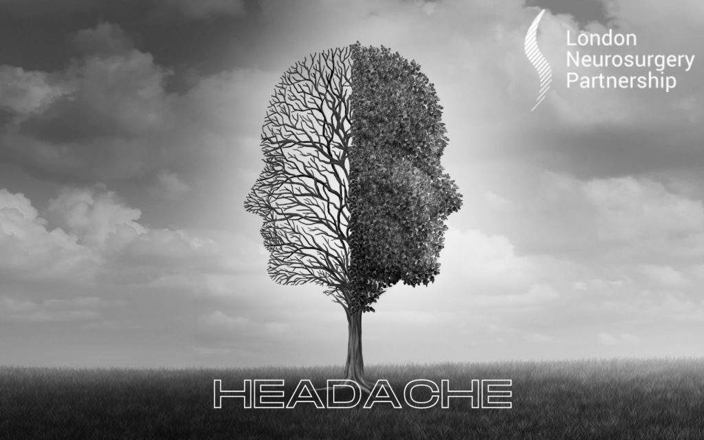 headache london neurosurgery partnership