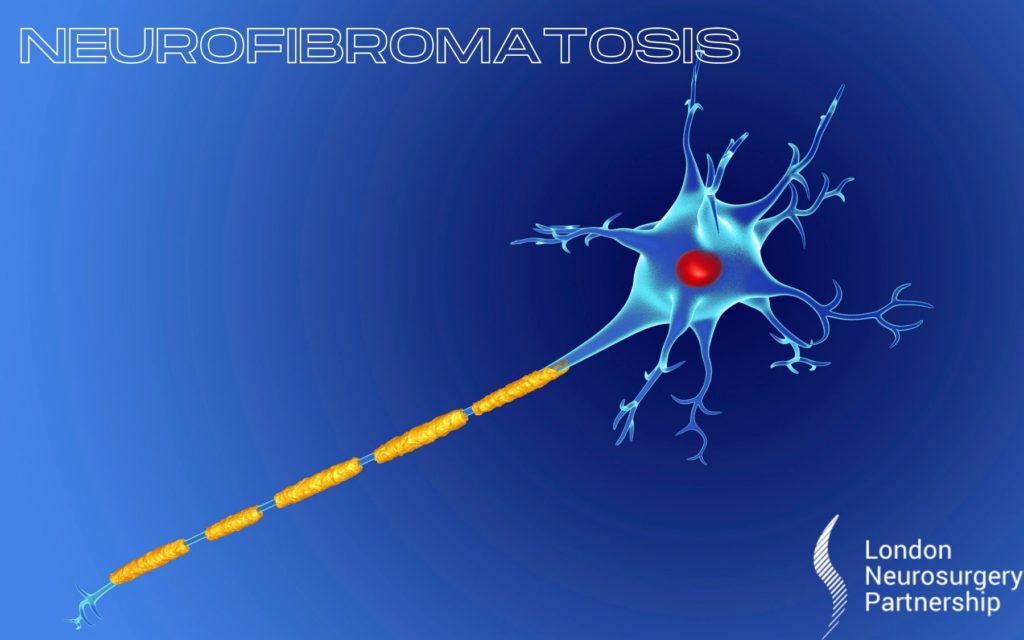 Neurofibromatosis london neurosurgery partnership