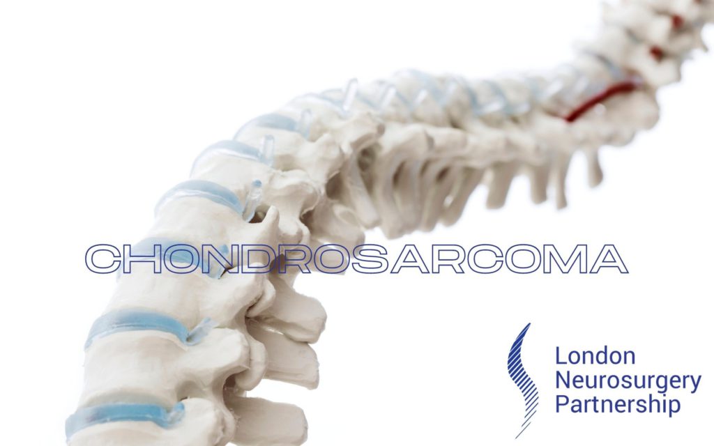 chondrosarcoma london neurosurgery partnership