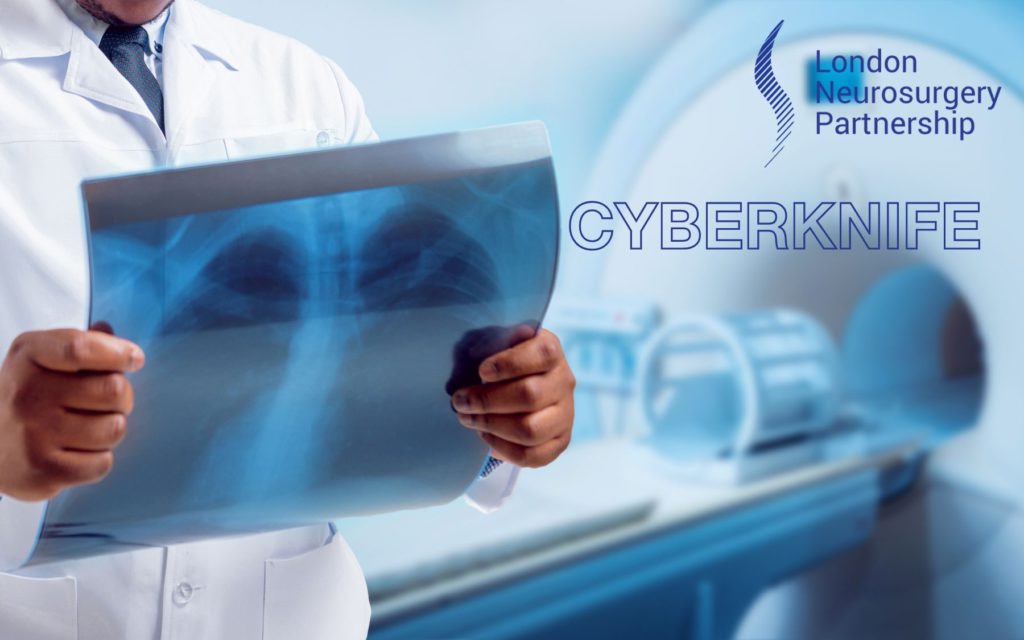 CyberKnife london neurosurgery partnership