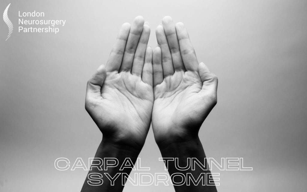 carpal tunnel syndrome