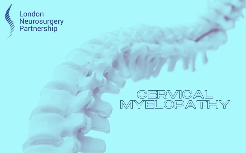 Cervical myelopathy london neurosurgery partnership