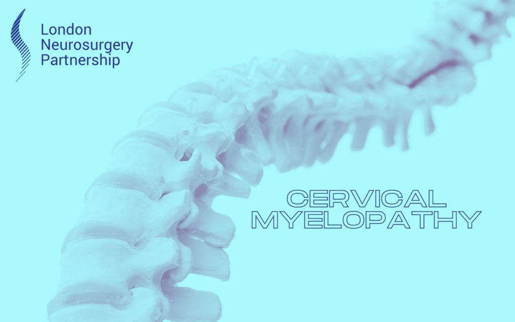 Vertebral compression fracture - London Neurosurgery