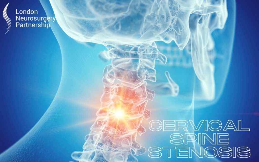 neurosurgery spine