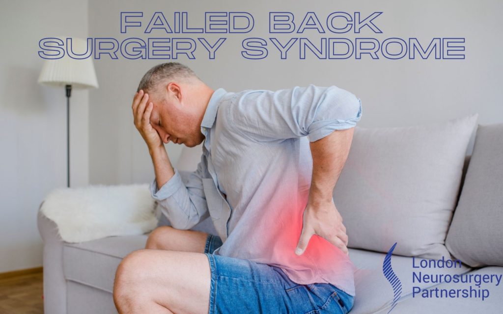 failed back surgery syndrom london neurosurgery partnership