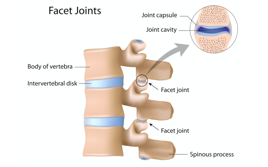 Lumbar Facet Irritation