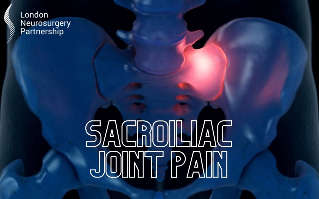 Sacroiliac Joint Sprain