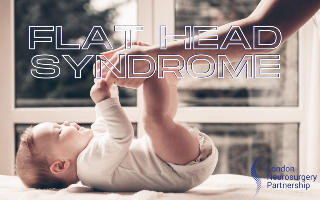 flat head syndrome london neurosurgery partnership