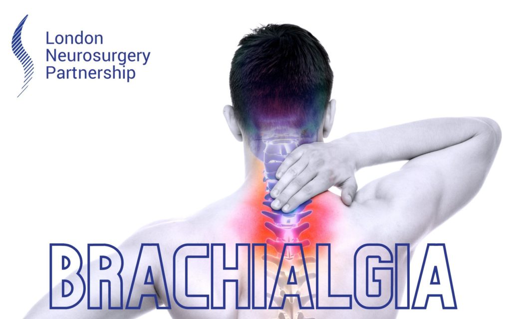 brachialgia london neurosurgery partnership