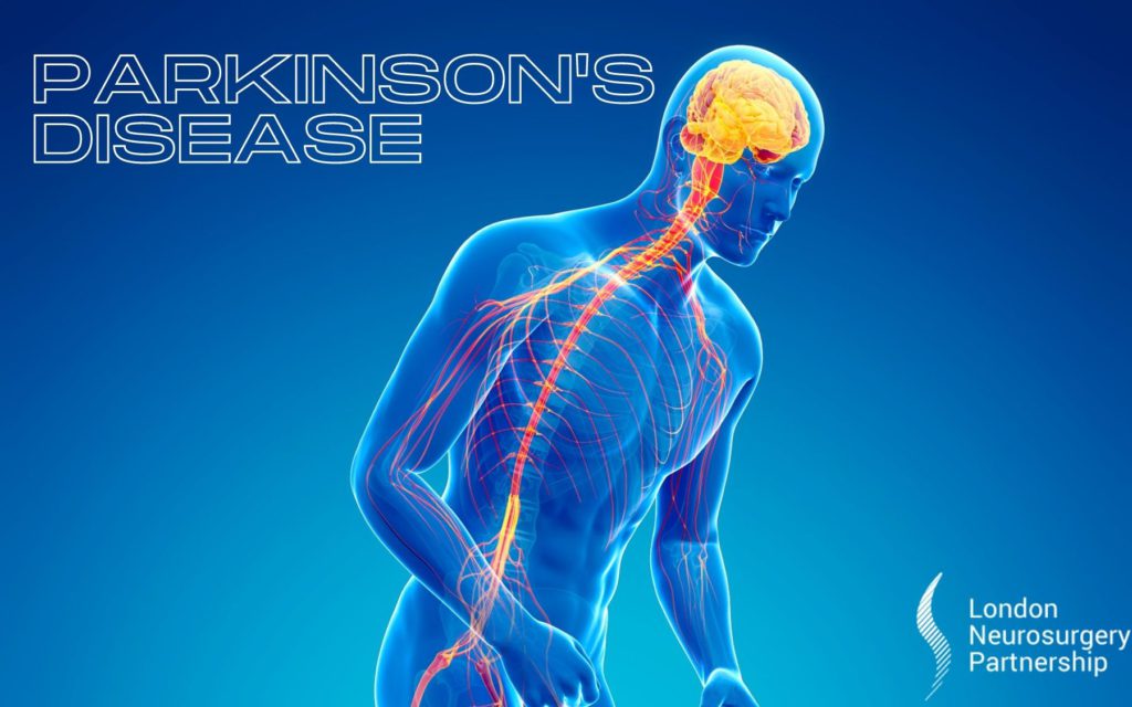 Parkinson's disease