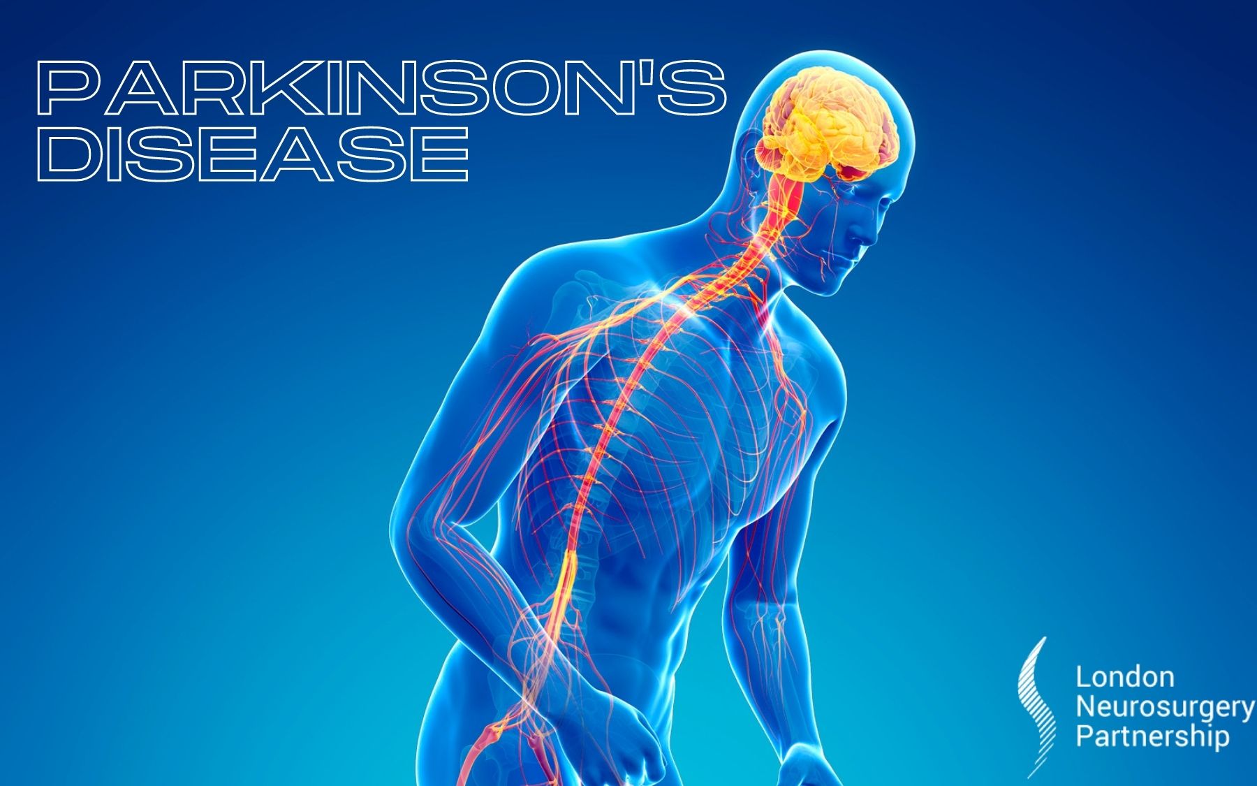 Parkinsons Disease London Neurosurgery Partnership 