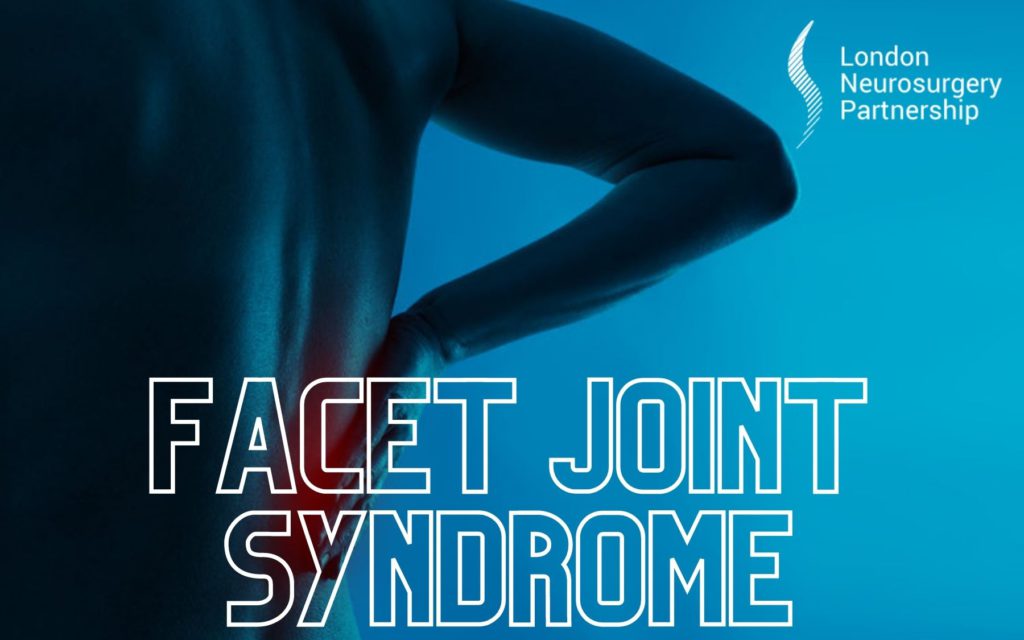 facet joint syndrome london neurosurgery partnership