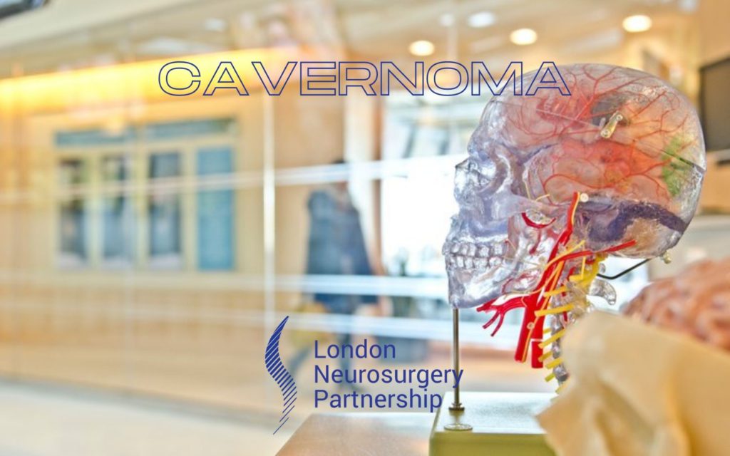 cavernoma london neurosurgery partnership