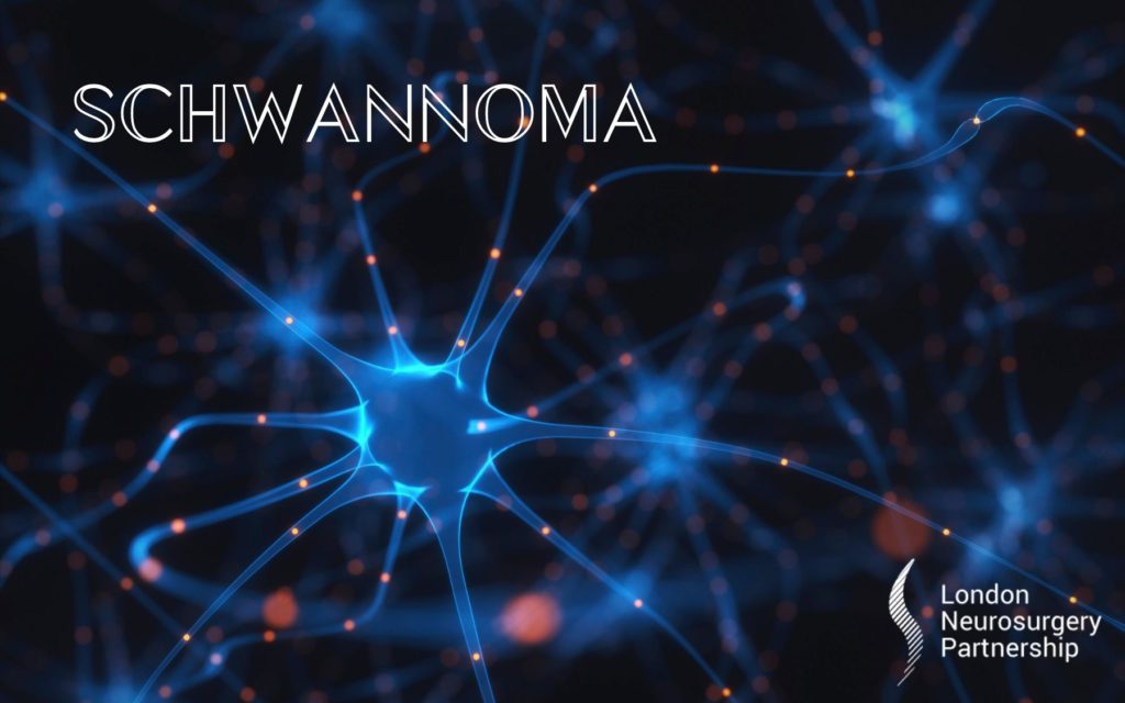 schwannoma london neurosurgery partnership