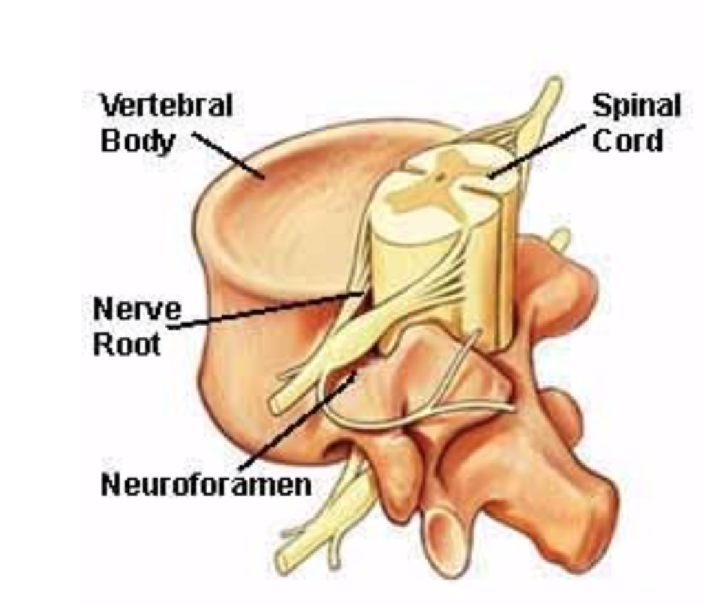 London+Neurosurgery+Partnership+foraminotomy