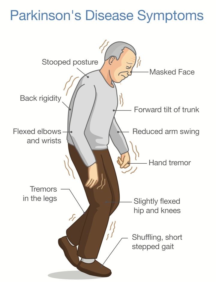 parkinsons disease LNP