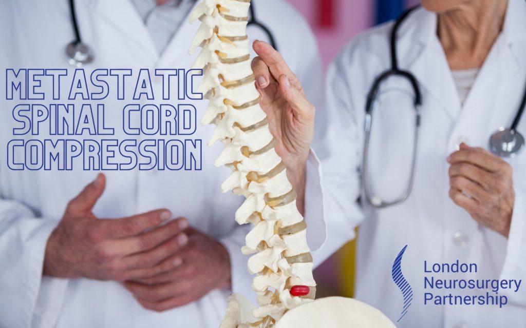 Metastatic spinal cord compression lnp