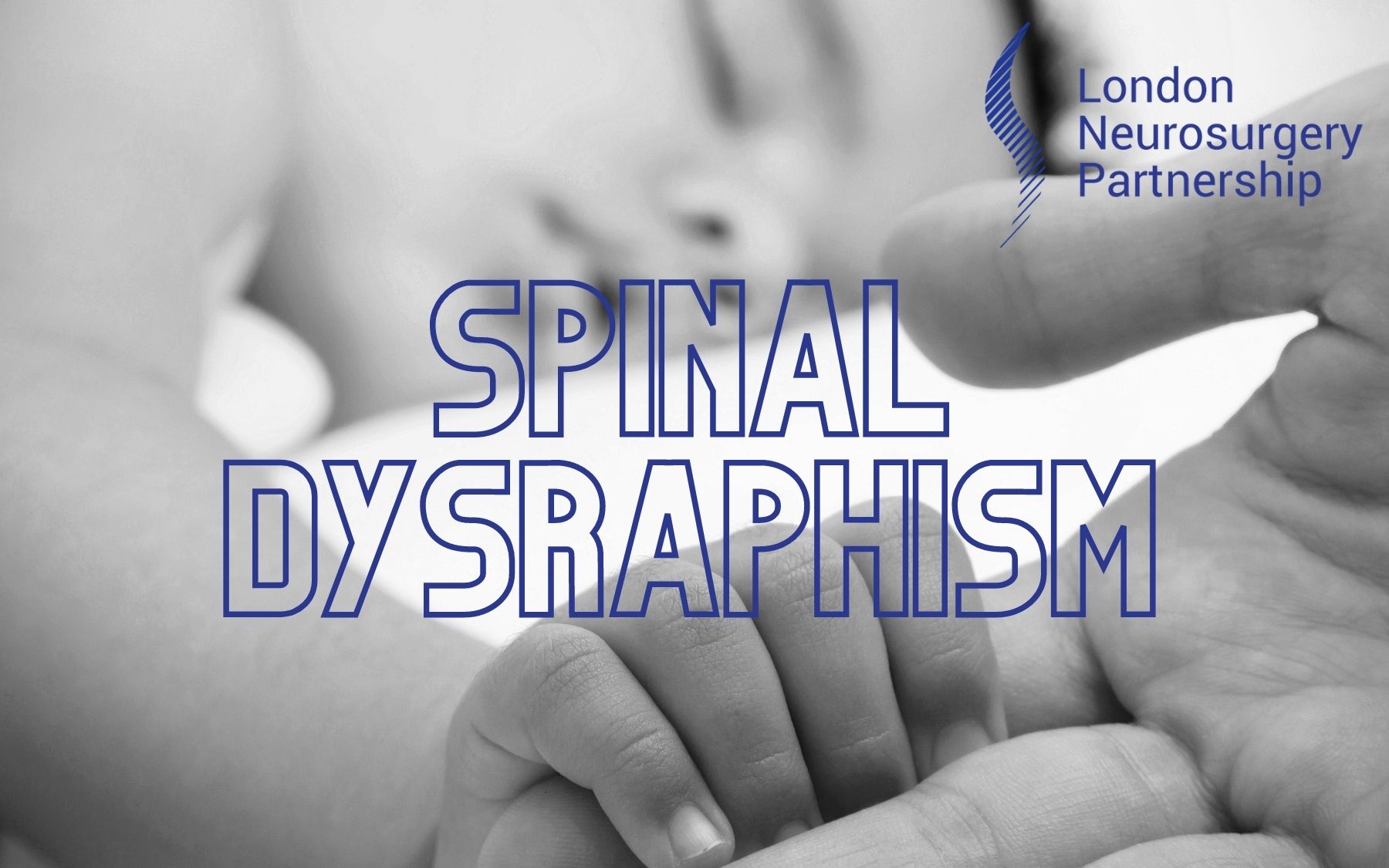 spinal dysraphism LNP