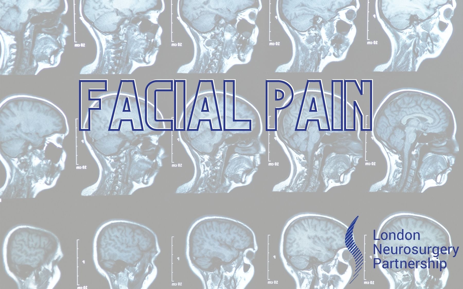 facial pain