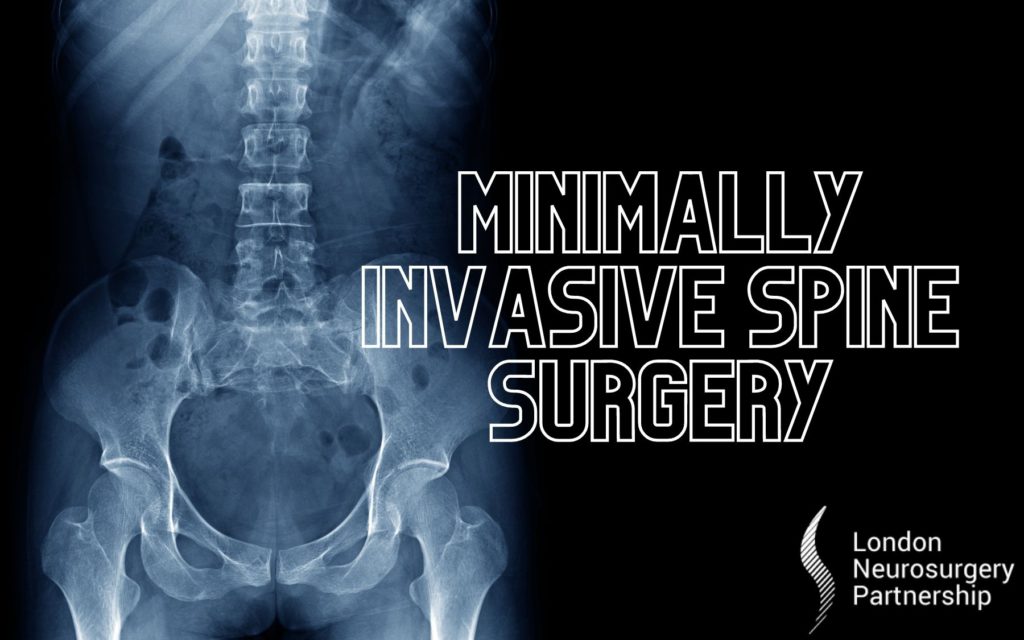 minimally invasive spine surgery