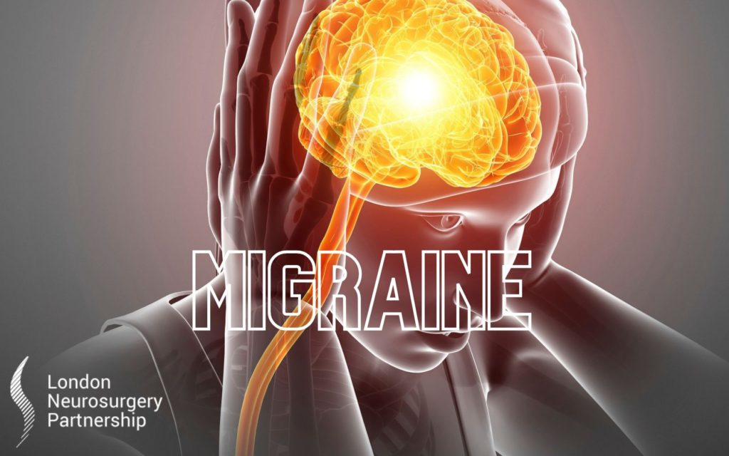 migraine london neurosurgery partnership