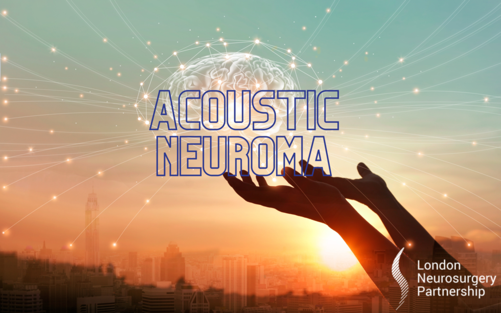 acoustic neuroma