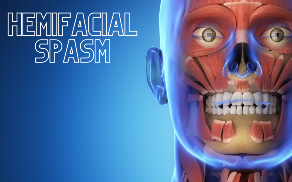 Hemifacial spasm