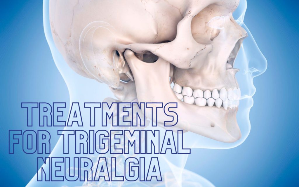 treatments for trigeminal neuralgia