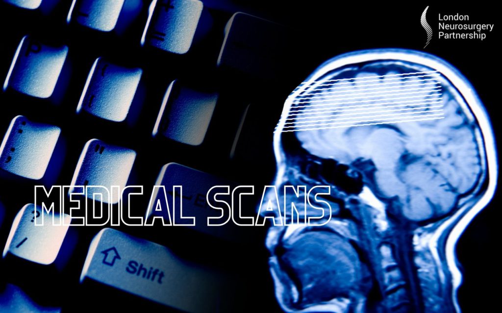 different types of scans