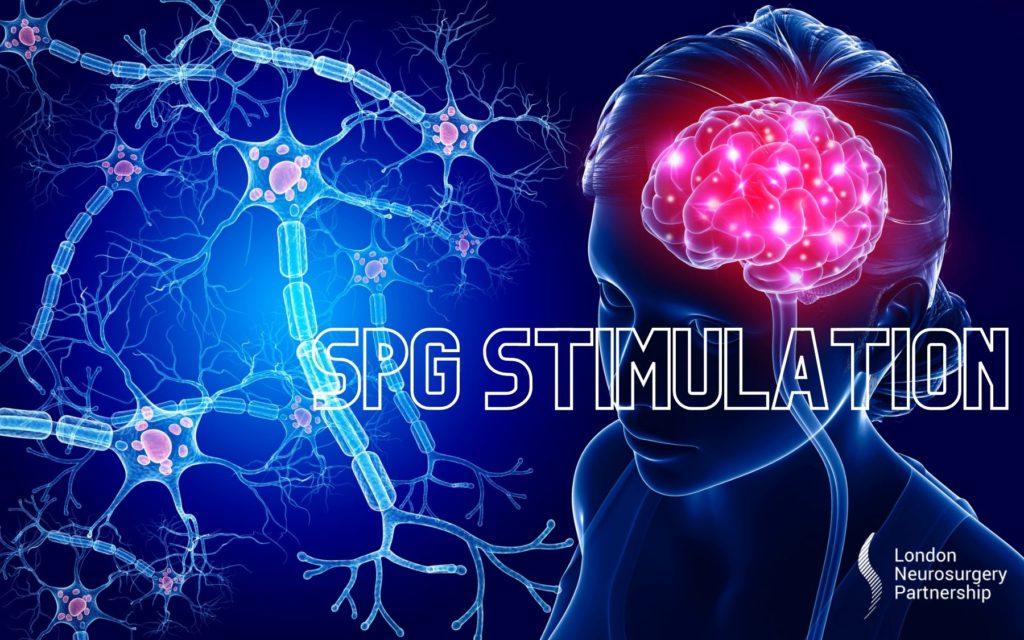 SPG stimulation