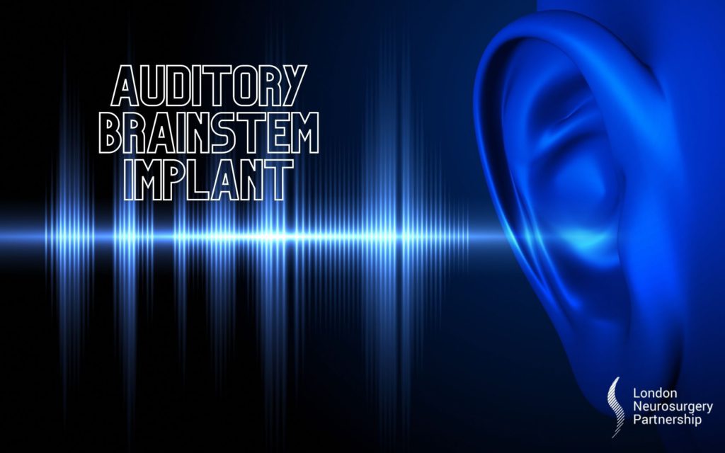 Auditory brainstem implant