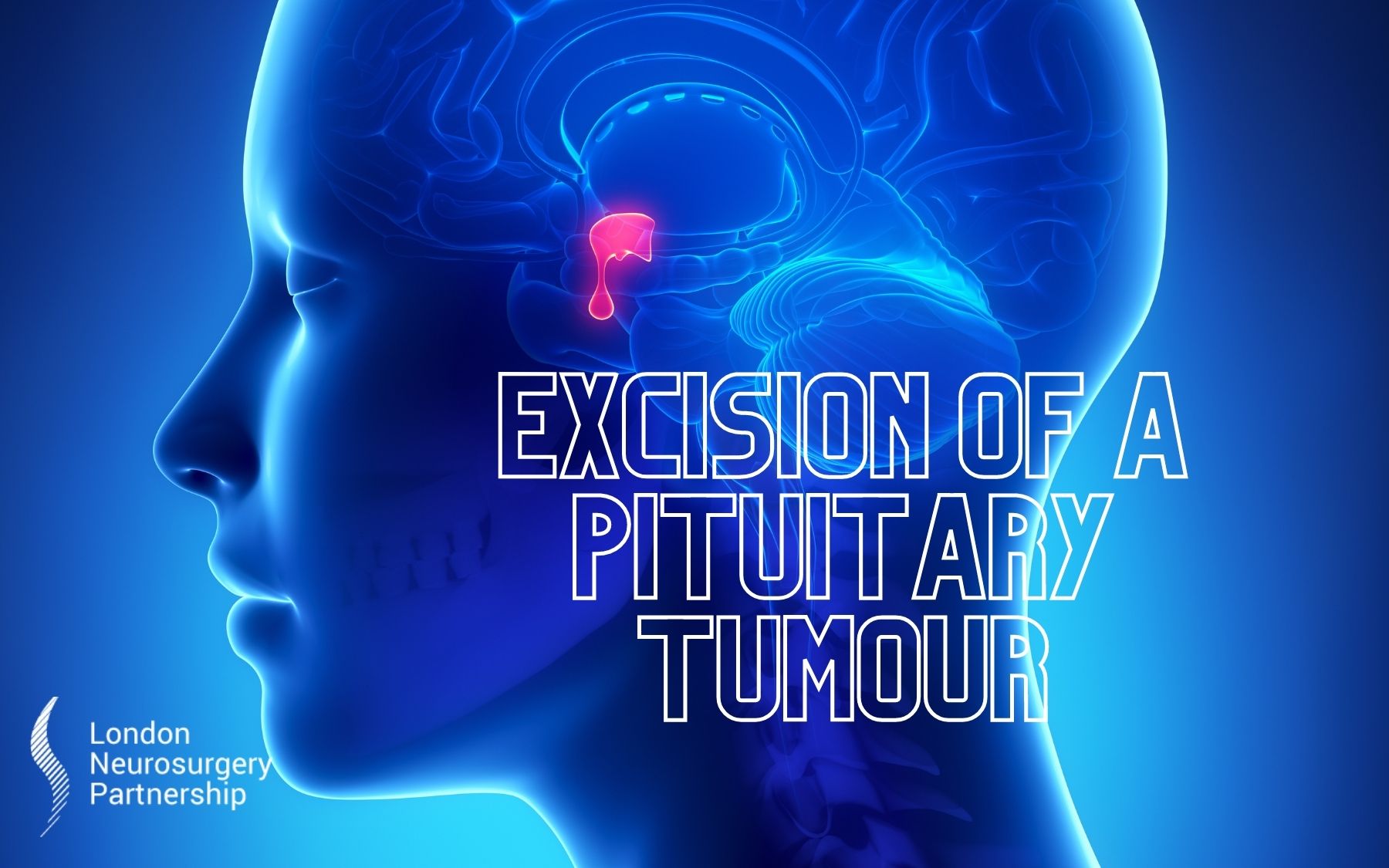 excision of a pituitary tumour