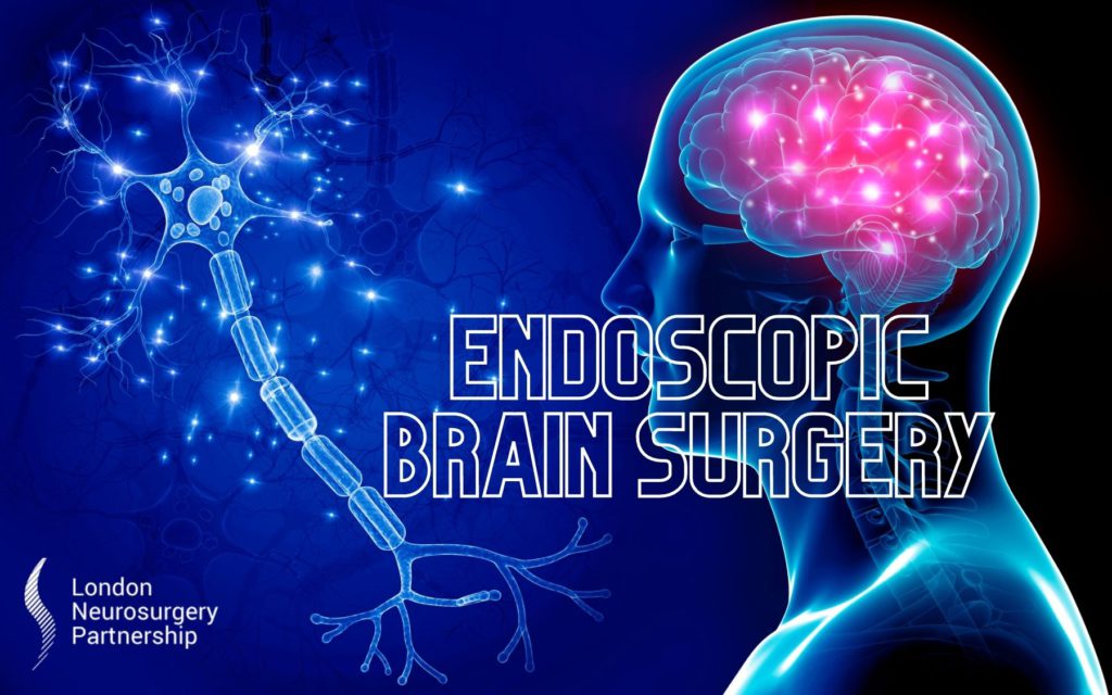 endoscopic brain surgery