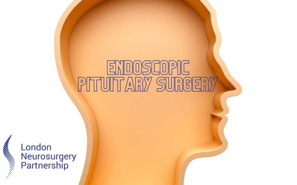 endoscopic pituitary surgery
