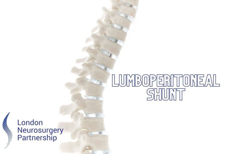 Lumboperitoneal shunt