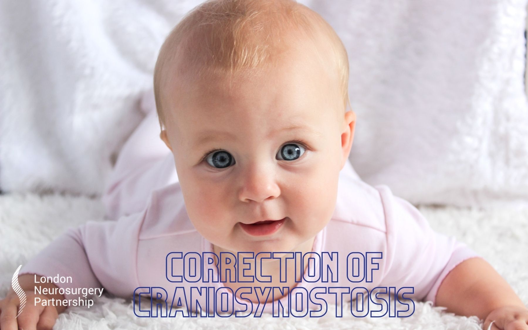 Correction of Craniosynostosis