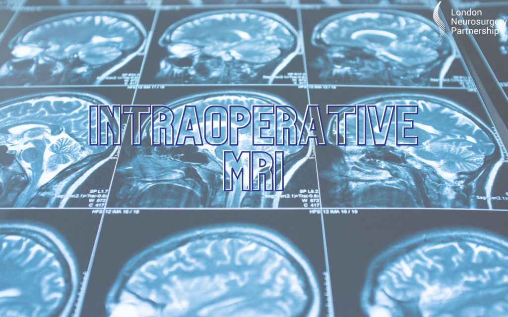 intraoperative MRI